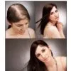 How to Stop Hair Lose --- Use Herbal Hair Regrow Spray - N.008 thumbnail-3