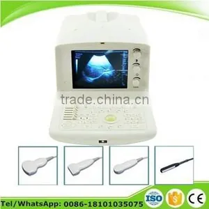 Portable Ultrasound Scanner Diagnostic System for Abdominal Obstetrics Gynecological Urological thumbnail-1
