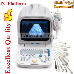 Medical Equipment Portable Diagnose/Cheapest Ultrasound Scanner/Machine for Veterinary and Human thumbnail-1