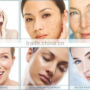 Elight SHR IPL Hair Removal &Skin Rejuveantion Elight Machine&ND Yag Laser thumbnail-5