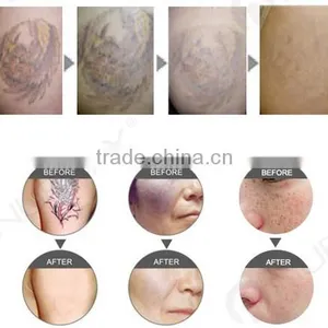 2017 Laser White Porcelain Doll Clinic Use thumbnail-5