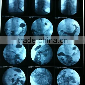 Fuji Dry Film, Konida Medical Equipment, Medical X-ray Film thumbnail-1