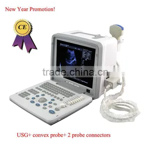 Factory Price!Notebook B-Mode Ultrasound Scanner/Ultrasound Machine With 3.5Mhz Multi-frequency Convex Probe RUS-9000B thumbnail-1