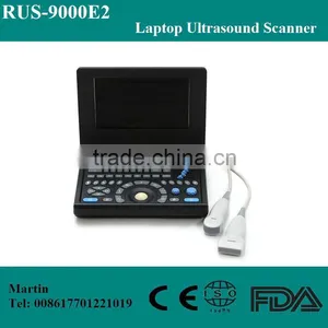 On Sale Model! Best Medical Use RUS-9000E2 Mini Laptop Portable Ultrasound Machine Two Probe/transducer Connectors thumbnail-1