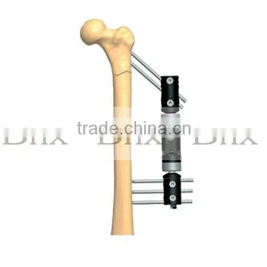 Bone Lengthening Fragment External Fixator thumbnail-1