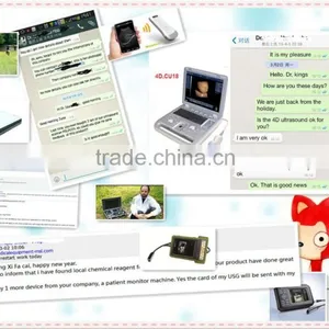 MSLPU25A HOT SALES Digital Best Medical Portable China Portable Ultrasound Machine Price thumbnail-2