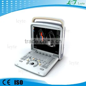 LTE6 Laptop Cardiac Color Doppler Vascular Ultrasound Scanner Machine thumbnail-1