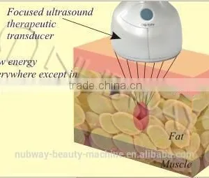 2015 Leading Technology HIFU Body Slimming,high Intensity Ultrasound Focused HIFU,HIFU thumbnail-2