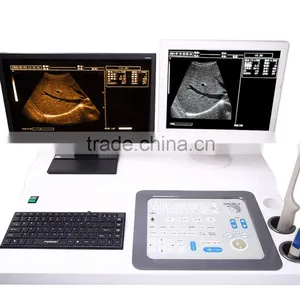 Portable Ultrasound /ultrasound Machine / 4d/3d/2d Ultrasound Scanner With Printer2018CIV thumbnail-6