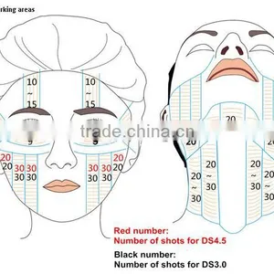 Hi Frequency Facial Machine GuangZhou BL High Intensity Focused Ultrasound HIFU Face Lifting Waist Shaping And Fat Removal Machine With CE High Focused Ultrasonic thumbnail-5