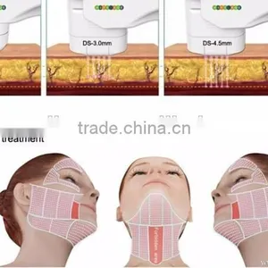 Hot Sale High Intensity Focuse Ultrasound Face Face and Neck Lift Machine thumbnail-2