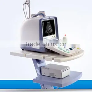 Portable USB Ultrasound Scanner Laptop Computer thumbnail-1