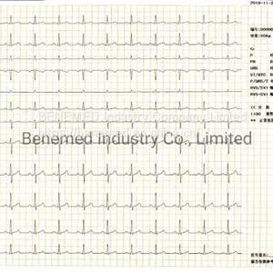 Benemed Hotsale Digital Hospital Electrocardiograph 12 Channel ECG Machine thumbnail-5