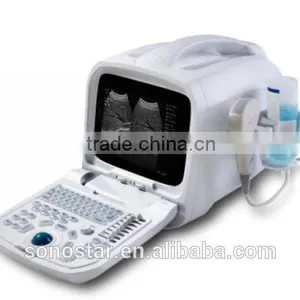 SS-7 Laptop Ultrasound Scanner thumbnail-3