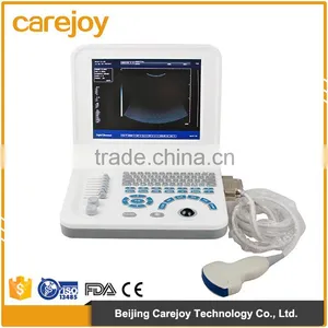 Hot Sale Sony Printer /medical Use Ultrasonic Diagnostic-Large Screen 10.4 Inch Laptop Ultrasound Scanner thumbnail-1