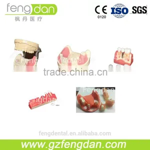 Dental Implant Practice Model With Removable Parts thumbnail-1