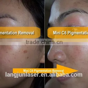 1-10Hz ND Yag Laser Modules / ND Yag Tattoo Removal Laser Equipment Laser Tattoo Removal Machine Tattoo Removal Laser Machine thumbnail-2