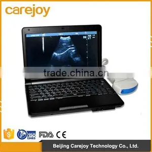 Hot Selling Cheap Price Full Digital Laptop Ultrasound Scanner RUS-9000F With 3.5Mhz Convex Probe Suitale for Emergency thumbnail-1