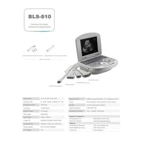 All Digital Ultrasonic Diagnosis SystemPortable Digital Acoustic Diagnostic Scanner for Human in Hospital thumbnail-5