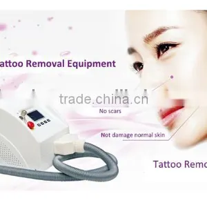 Without Scars Tattoo Removal Options Beauty Equipment NDYAG Laser thumbnail-1