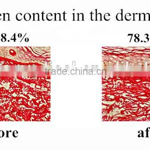 Acne Removal 590nm Yellow 2015 Hot Sale Portable Photon Therapy Multi-Function LED PDT Machine /pdt Led Light Skin Beauty Machine Skin Rejuvenation thumbnail-4