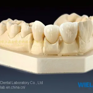 Wieland Zenostar Dental Crown, Solid Zirconia Bruxzir, Dental Teeth, Laboratoire Dentaire, Dentallabor, Laboratorio Dental, Dental Laboratory, Shenzhen LJ Dental Lab China thumbnail-2