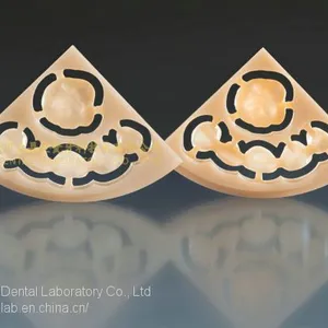 Wieland Zenostar Dental Crown, Solid Zirconia Bruxzir, Dental Teeth, Laboratoire Dentaire, Dentallabor, Laboratorio Dental, Dental Laboratory, Shenzhen LJ Dental Lab China thumbnail-4