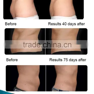 Newest CE Certification Cryotherapy Machine Fat Freezing Slimming Machine thumbnail-6
