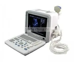 Carejoy Portable Ultrasound Machine Ultrasounic Scanner With 3.5Mhz Convex Probe RUS-9000B With CE ISO Mark thumbnail-4