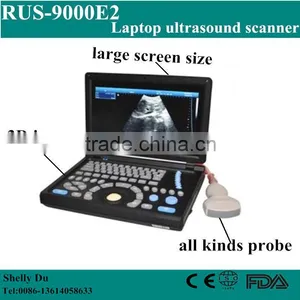 2016 China Medical Portable Mini Laptop Notebook B Mode B/W Ultrasound Machine Scanner With CE(PC Based) RUS-9000E2 thumbnail-1