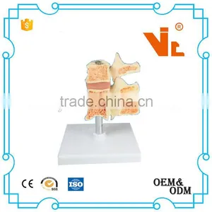 V-AM026 Spine Model thumbnail-1