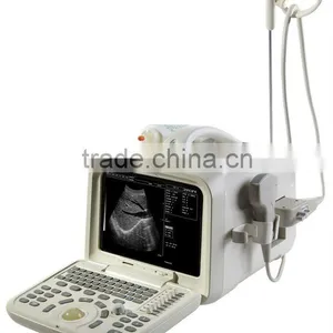 Portable Ultrasound Scanner thumbnail-1