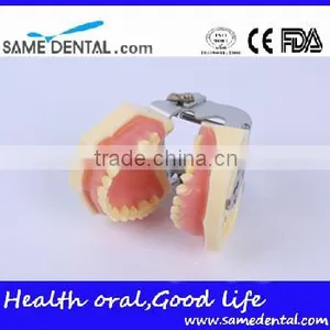 Dental Moderate Periodontal Disease Model Teaching Demonstration thumbnail-5