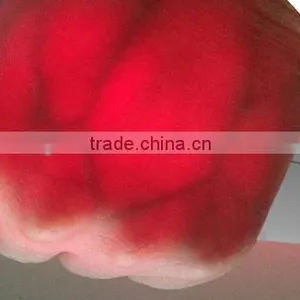 New Medical Equipment Hot Sale Vein Finder thumbnail-1