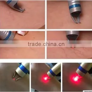 Bipolar rf Skin Tightening Machine /wrinkle Removal and Face Lifting Machine/home Use Factional rf Equipment thumbnail-4