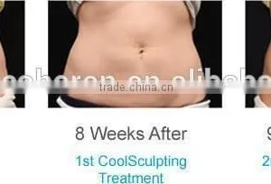 Cellulite Freezing Cool Shaping Body Massage Equipment for Weight Loss thumbnail-4