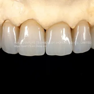Crown & Bridge A Professional Outsourcing Dental Lab. thumbnail-3