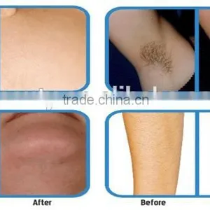 Portable IPL SHR&E-light Hair Removal Equipment&machine thumbnail-5