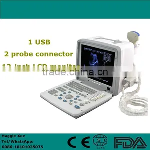 Digital LCD Portable Ultrasound Scanner USG Medical Machine Manufacturer thumbnail-1