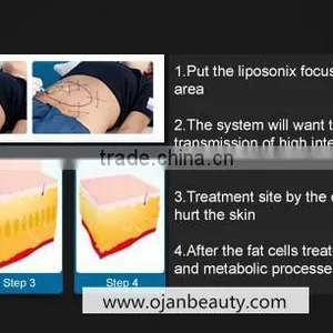 2016 Best Weight Loss Machine Liposunix Slimming Fat Removal / Liposunix Slimming Machine thumbnail-4