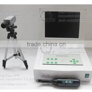 Infrared Mammary Gland Diseases Detector Women Breast Biopsy Analyzer Machine thumbnail-2