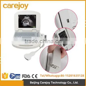 Full Digital Portable Ultrasound Scanner With 96 Elements Probes thumbnail-1