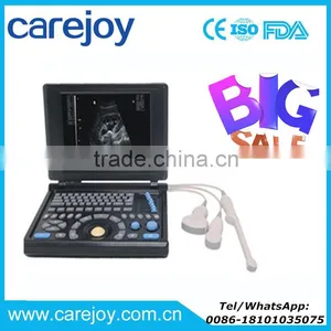 CE Ultrasonic System PC Platform 10.4 Inch Laptop Ultrasound Scanner / Machine With 3.5Mhz Convex Probe Li-ion Battery thumbnail-1
