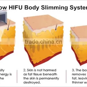 2016 B-028 GLM Liposlim Beauty Eqiupment Hifu Beauty/hifu Multi-polar RF For Body/hifu Slimming Machine With CE For Sale 0.1-2J thumbnail-5