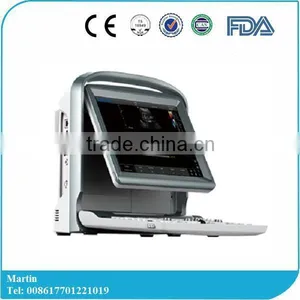 New Laptop 3D/4D Color Doppler Ultrasound System Ultrasound Color Doppler Portable thumbnail-1