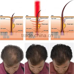 Salon Equipment Hair Growth Machine /laser Hair Regrowth Machine thumbnail-6