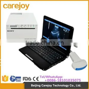 Laptop 10.1 Inch LCD pc Ultrasound Machine for Scan With 3D Function thumbnail-1