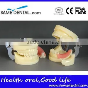 Dental Implant Practice Model DEA-31 Teeth Implant Models thumbnail-1