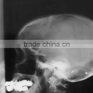 Medical Dry Films,medical Films.fuji Dry Film thumbnail-3