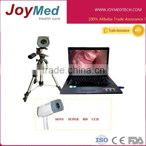 The Most Advanced Digital Video Photoelectron Colposcope thumbnail-1